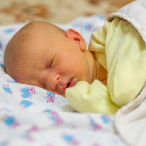 jaundice in newborn