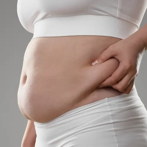 Belly Fat After C Section